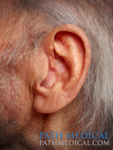 facts-about-alzheimers_path_web